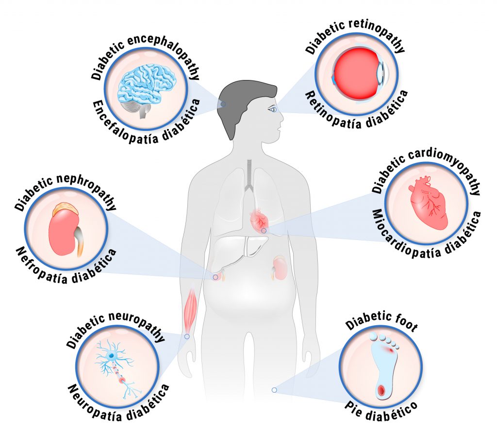 Diabetes – River Valley Health Services